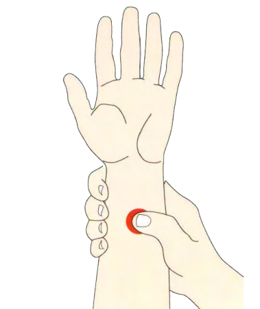 Akupressur Pe 6